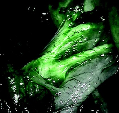 Tissue - fluorescence